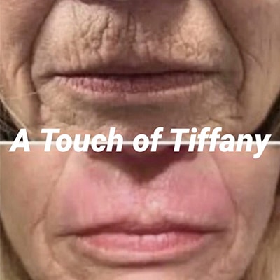 A touch of Tiffany before & after
